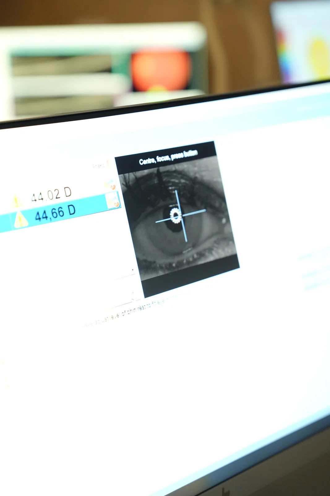 Trifocal lens surgery in Istanbul